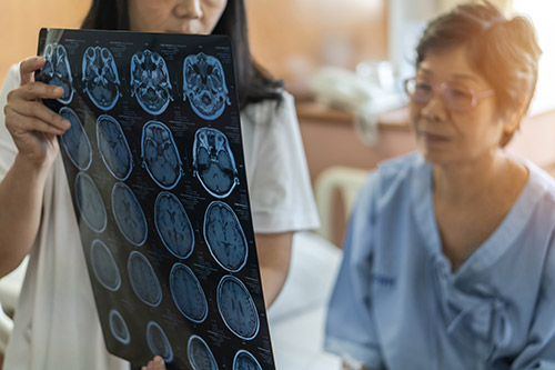 Diagnosing Alzheimer’s Disease - Villa Rica, GA